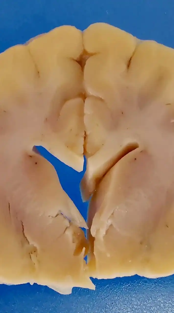 VET NEUROANATOMY 2025