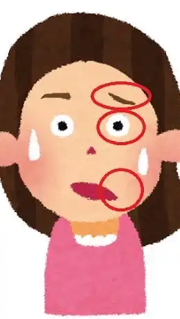 🥴顔面神経麻痺🥴を考える