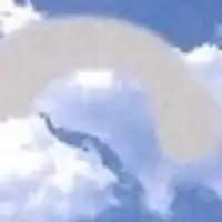 レーベル病👀レーベル遺伝性視神経症