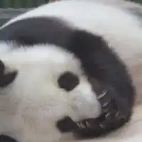 醜形恐怖症